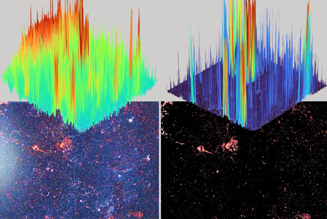 Artificial intelligence and TB. Image Wenshu Zheng.