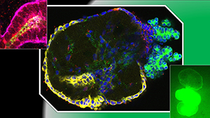 Mini-kidney tube structures have sugar receptors (red, upper left) and form outward-facing PKD cysts (center), which swell by taking in sugar (green, lower right).  Image courtesy of Benjamin Freedman Lab.