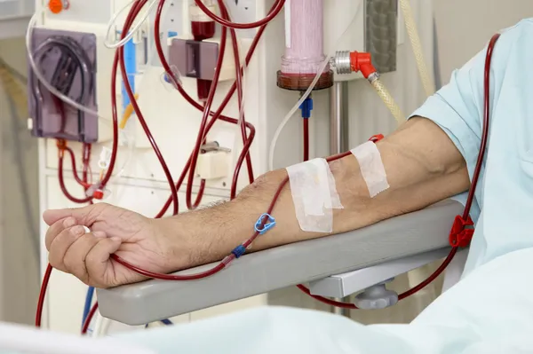 Dialysis stock image