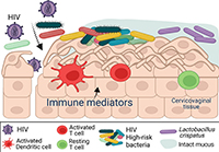 In the presence of certain bacterial vaginosis-associated bacteria, the mucosal barrier breaks down and immune cells are activated and become more susceptible to HIV infection (in red). Dr. Sujatha Srinivasan and colleagues identified 14 bacteria groups and six inflammatory proteins associated with high risk of HIV infection in women with bacterial vaginosis. Adapted from Srinivasan, S. et al., J Infectious Diseases, 2024