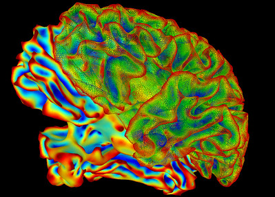 Multi-color image of whole brain for brain imaging research. This image was created using a computer image processing program (called SUMA), which is used to make sense of data generated by functional Magnetic Resonance Imaging (fMRI).