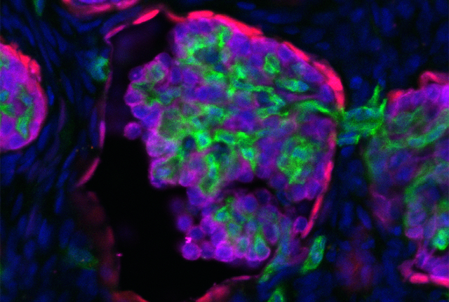 Image of kidney tissue containing human filtering cells (purple and red) integrating with mouse blood vessels (green). Nuclear DNA stained is in blue and the total size of the image is ~ 0.2 mm. Image by Benjamin Freedman lab. 
