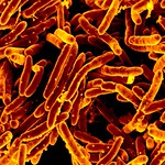 Mycobacterium tuberculosis Bacteria Scanning electron micrograph of Mycobacterium tuberculosis bacteria, which cause TB.     Credit: National Institute of Allergy and Infectious Diseases, National Institutes of Health.