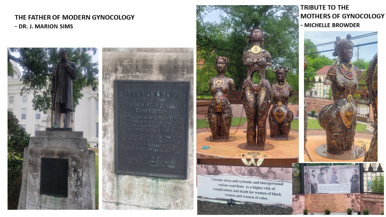 James Marion Sims and Michelle Browder statues